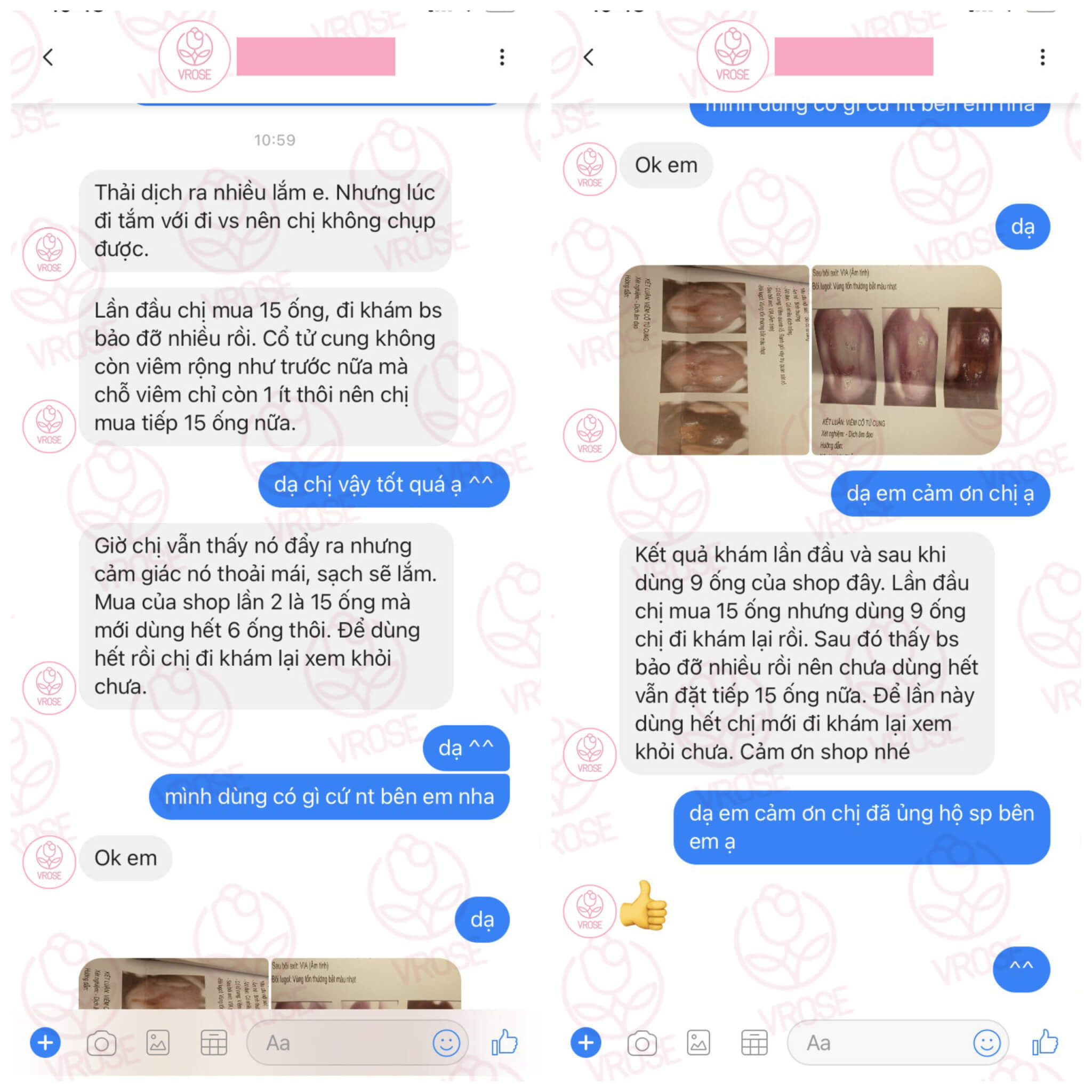 Feedback trị viêm phụ khoa